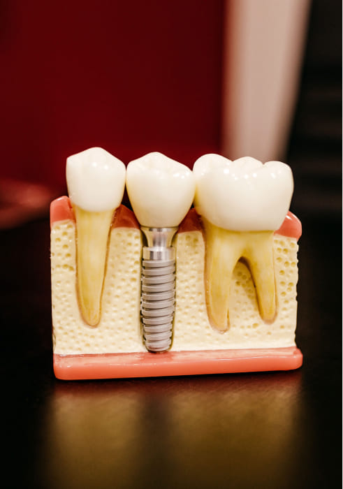 Имплантология