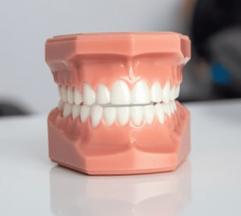 Отбеливание зубов