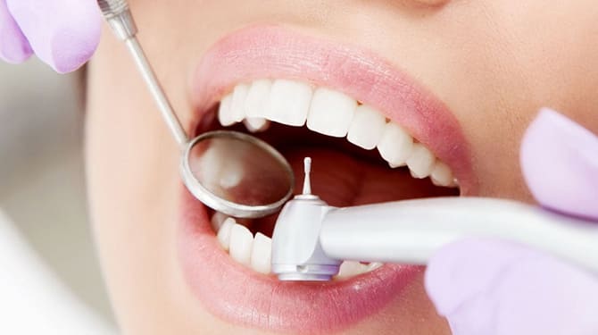 Лечение кариеса лазером Томск Проточная стоматология в томске на кирова