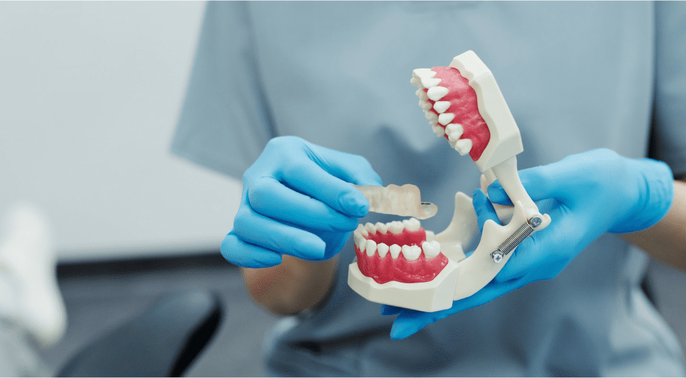 Цифровая стоматология. Виниры